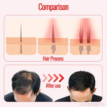 Load image into Gallery viewer, low-level laser therapy (LLLT) for hair
